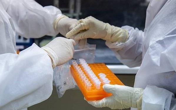 جدیدترین آمار مبتلایان به ویروس کرونا در 24 ساعت گذشته ، 3276 نفر از مبتلایان بهبود یافتند