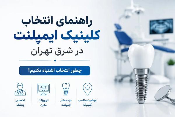 راهنمای انتخاب کلینیک ایمپلنت در شرق تهران؛ چطور انتخاب اشتباه نکنیم؟
